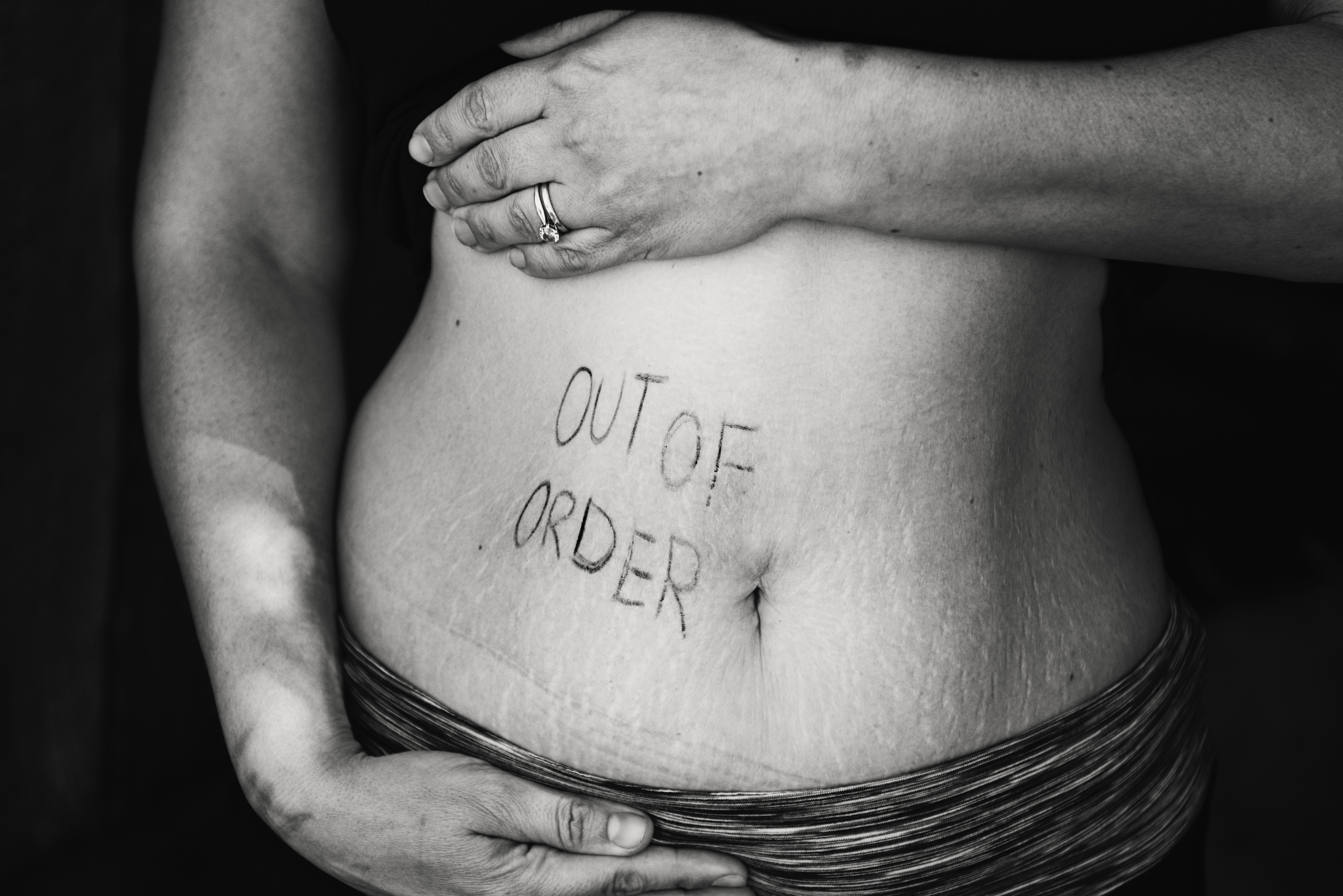 Bauch vor und nach schwangerschaft